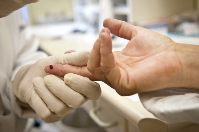Brasil tem 827 mil vivendo com HIV; 112 mil não sabem que estão infectados (Imagem: Agência Brasil)