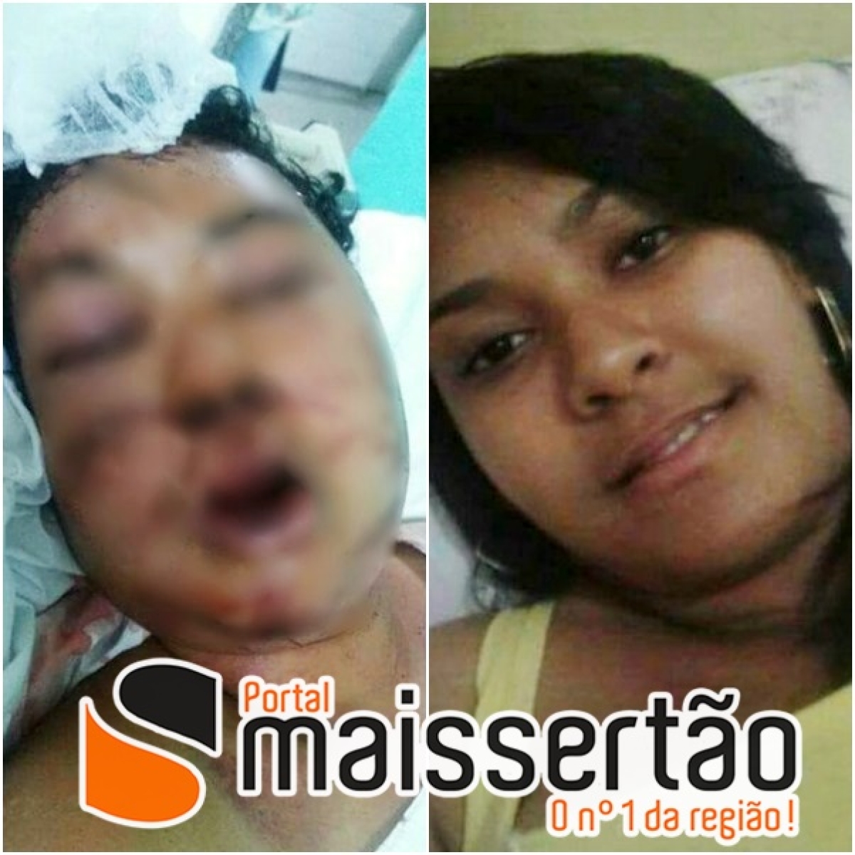 Gloriense é agredida a pedradas e é socorrida em estado grave com rosto desfigurado (Imagem: Portal Mais Sertão) Gloriense é agredida a pedradas e é socorrida em estado grave com rosto desfigurado (Imagem: Portal Mais Sertão)