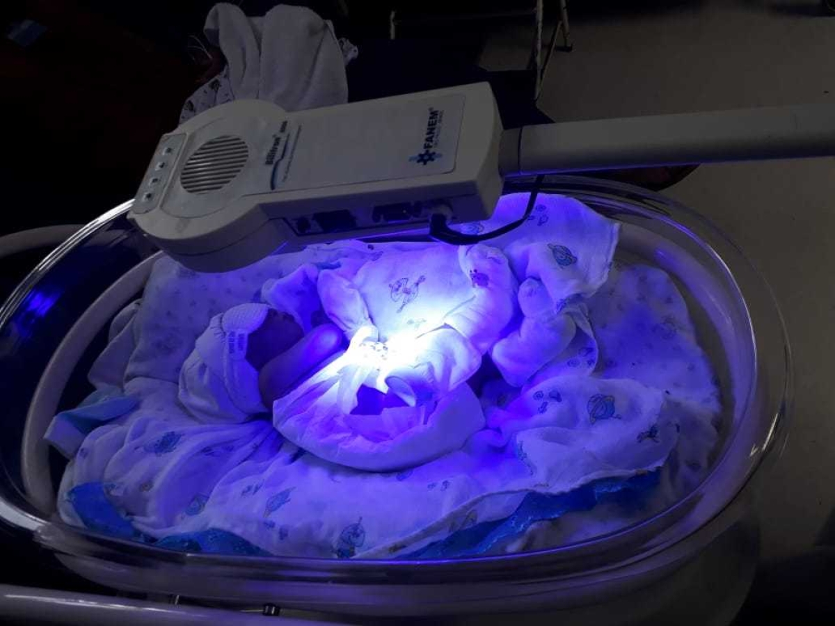 Pediatra fala sobre Icterícia neonatal em recém-nascidos (Foto: SES/SE)