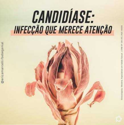 Candidíase: infecção ginecológica que atinge 3 a cada 4 mulheres pelo menos uma vez na vida (Imagem: Divulgação)