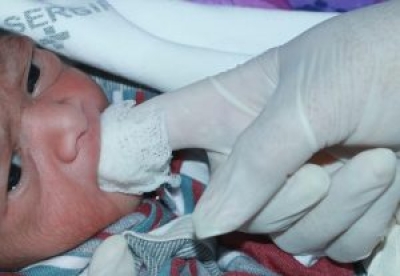 ? preciso higienizar a cavidade bucal do bebê após a amamentação (Foto: SES/SE)