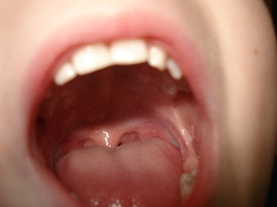 Saliva permite medir a porcentagem de gordura corporal (Foto ilustrativa: Pixabay)
