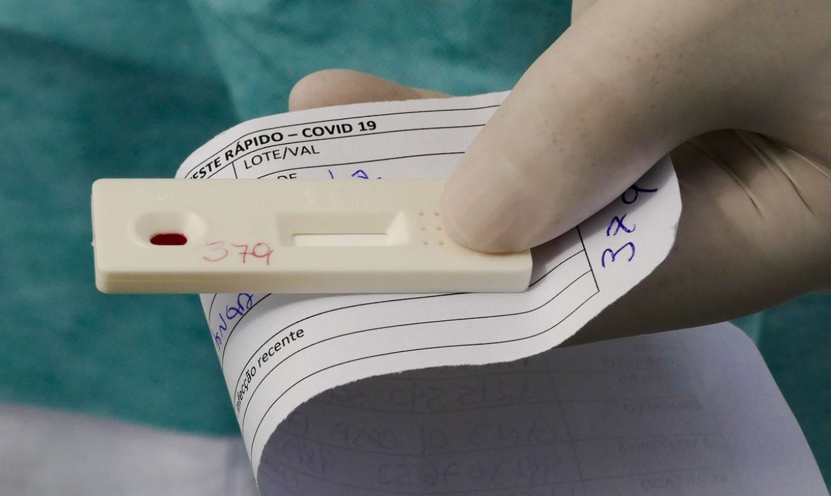 ANS decide se teste para covid-19 é procedimento obrigatório de planos (Foto: Leopoldo Silva/ Agência Senado)