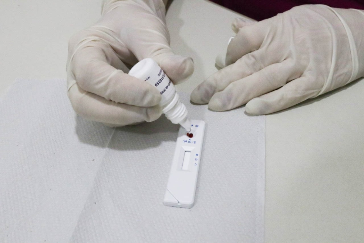 Biomédica explica diferença entre PCR, teste-rápido e sorologia para detecção da Covid-19 (Foto: SES/SE)