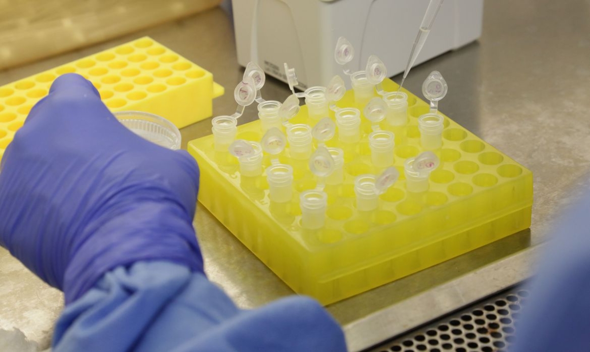Testes para vacina contra HIV têm resultados promissores (Foto: Divulgação/ Josué Damacena/ IOC/ Fiocruz)