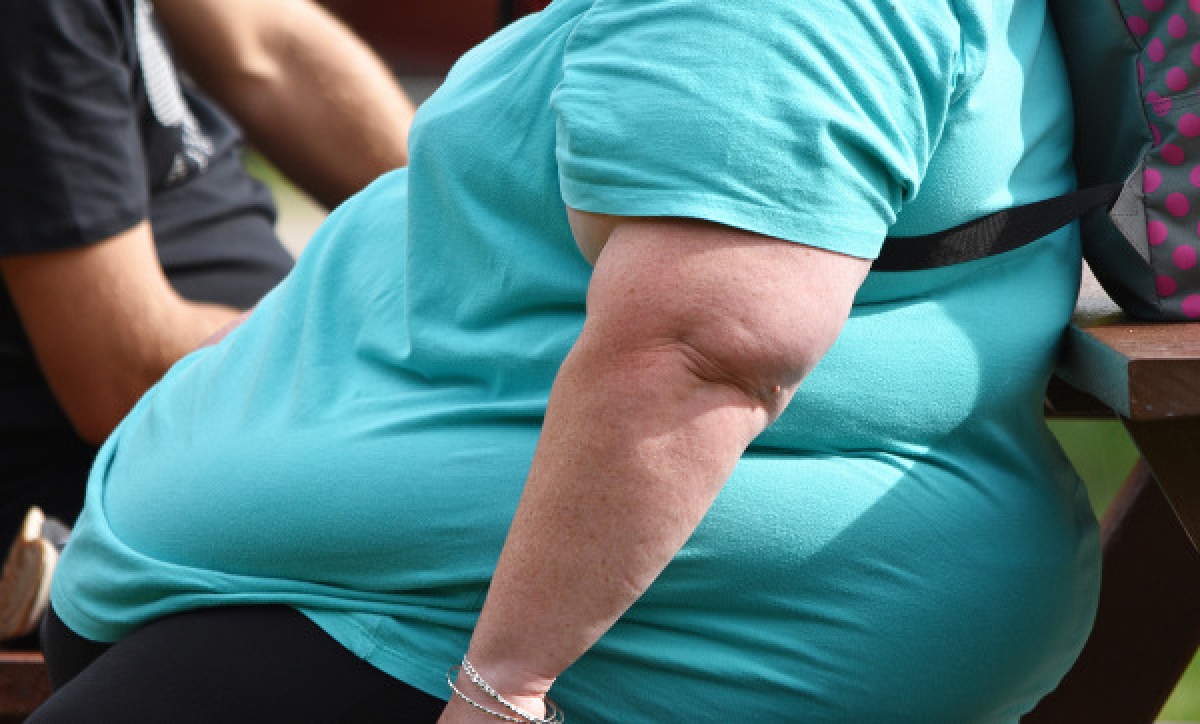 Pessoas com obesidade devem redobrar os cuidados com a Covid-19 (Foto: SES/SE)