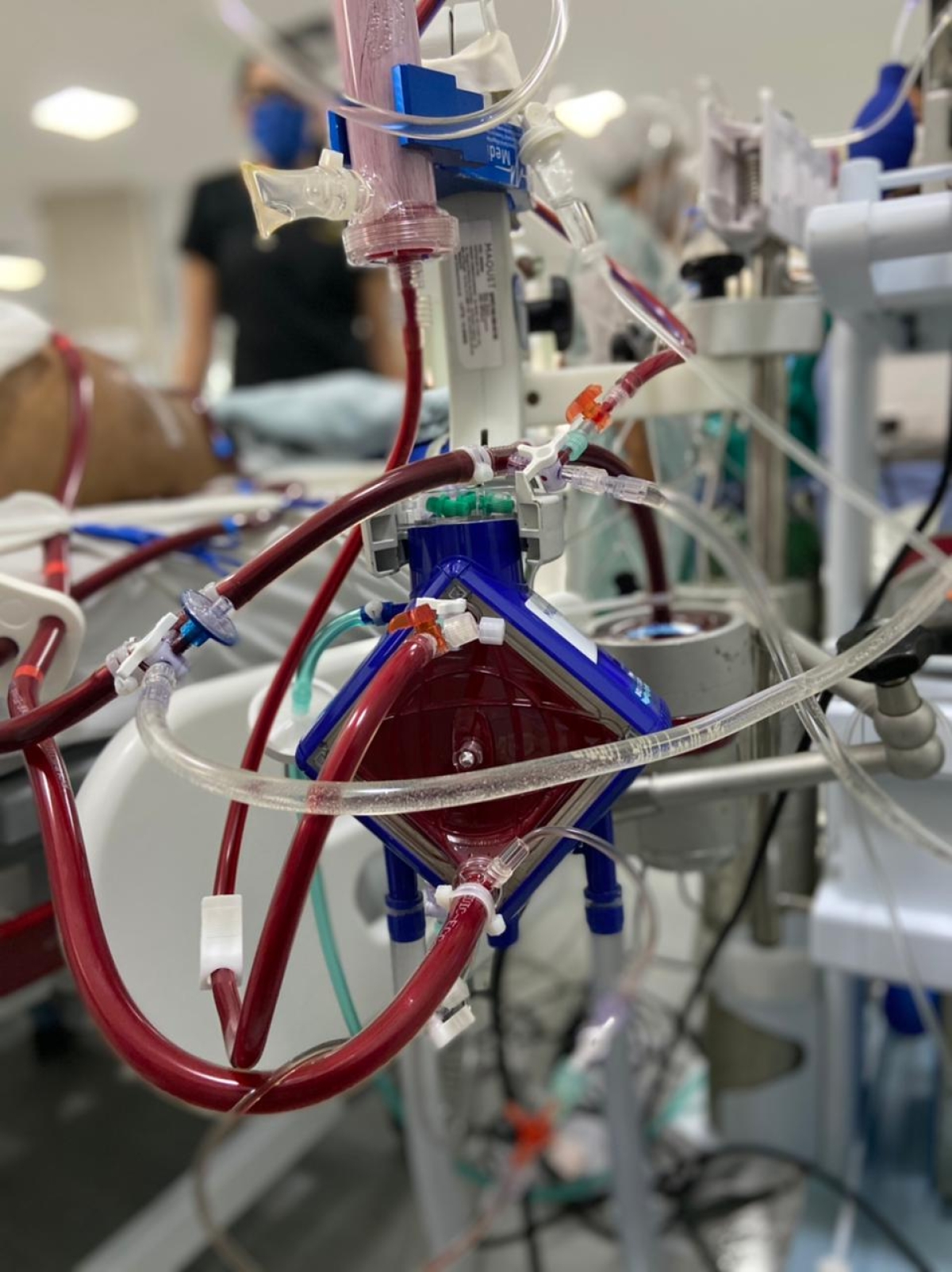 Hospital de Cirurgia realiza tratamento por ECMO de forma inédita em Sergipe (Foto: Hospital de Cirurgia)