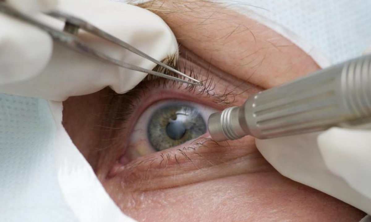 Consultas regulares ao médico podem afastar risco de glaucoma (Foto: Divulgação/ Prefeitura de Três Barras/SC)