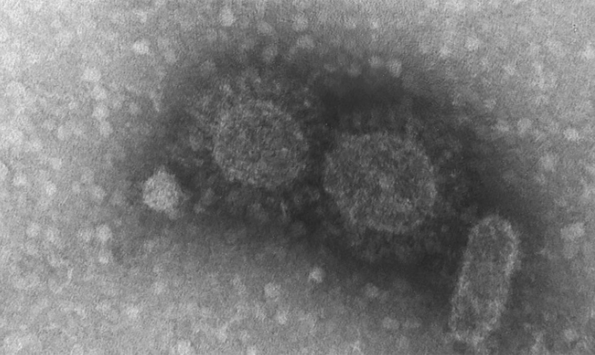 Maioria das doenças infecciosas tem origem em animais selvagens (Foto: Instituto Adolfo Lutz)