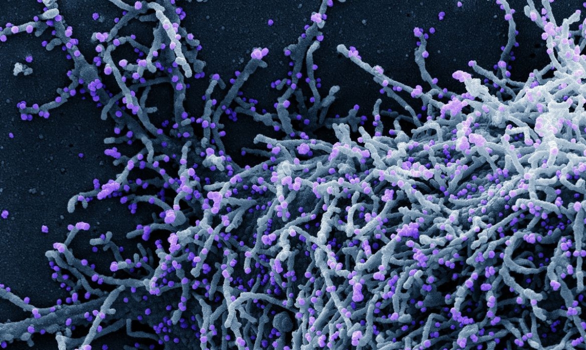 Novo Coronavírus SARS-CoV-2 (Imagem: National Institute of Allergy and Infectious Diseases/ NIAID)