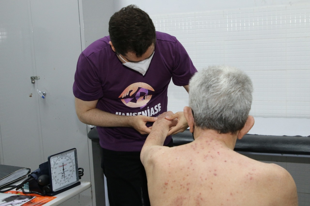 Campanha de combate à Hanseníase oferece exames à população no Hospital Universitário da UFS (Foto: Valter Sobrinho/ SES/SE)