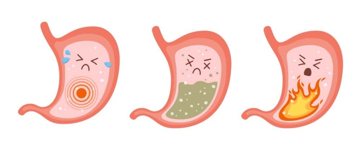 Bactéria causadora da gastrite é resistente a antibióticos, diz estudo (Imagem: Olhar Digital)