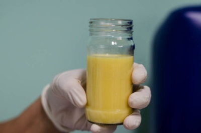 Baixo estoque de leite humano pode comprometer a saúde de bebês prematuros - Foto: SES/SE Baixo estoque de leite humano pode comprometer a saúde de bebês prematuros - Foto: SES/SE