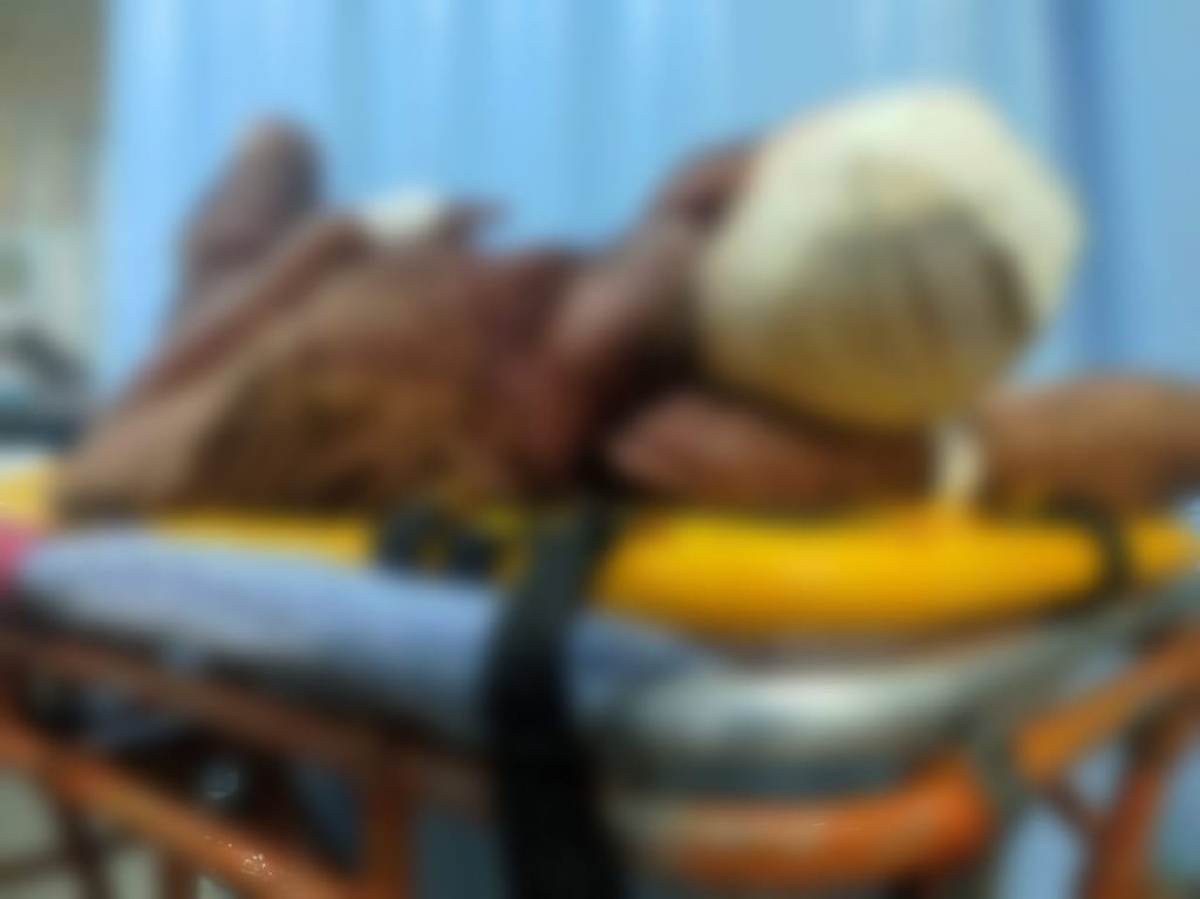 Saúde alerta sobre riscos de trauma na face - Foto: SES/SE Saúde alerta sobre riscos de trauma na face - Foto: SES/SE