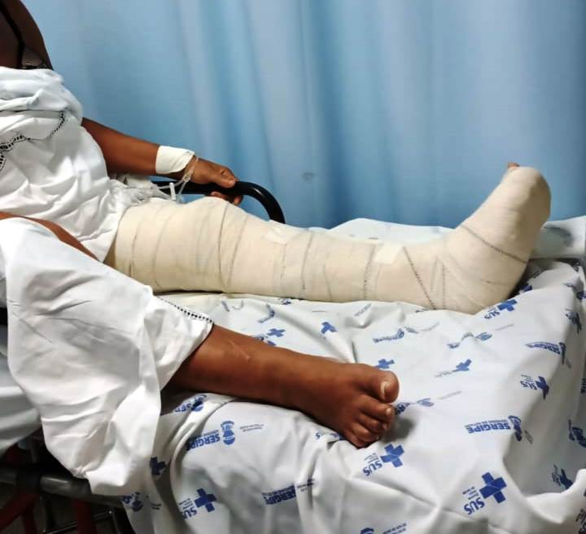 Cresce o número de cirurgias ortopédicas no Hospital de Urgências de Sergipe - Foto: SES/SE Cresce o número de cirurgias ortopédicas no Hospital de Urgências de Sergipe - Foto: SES/SE