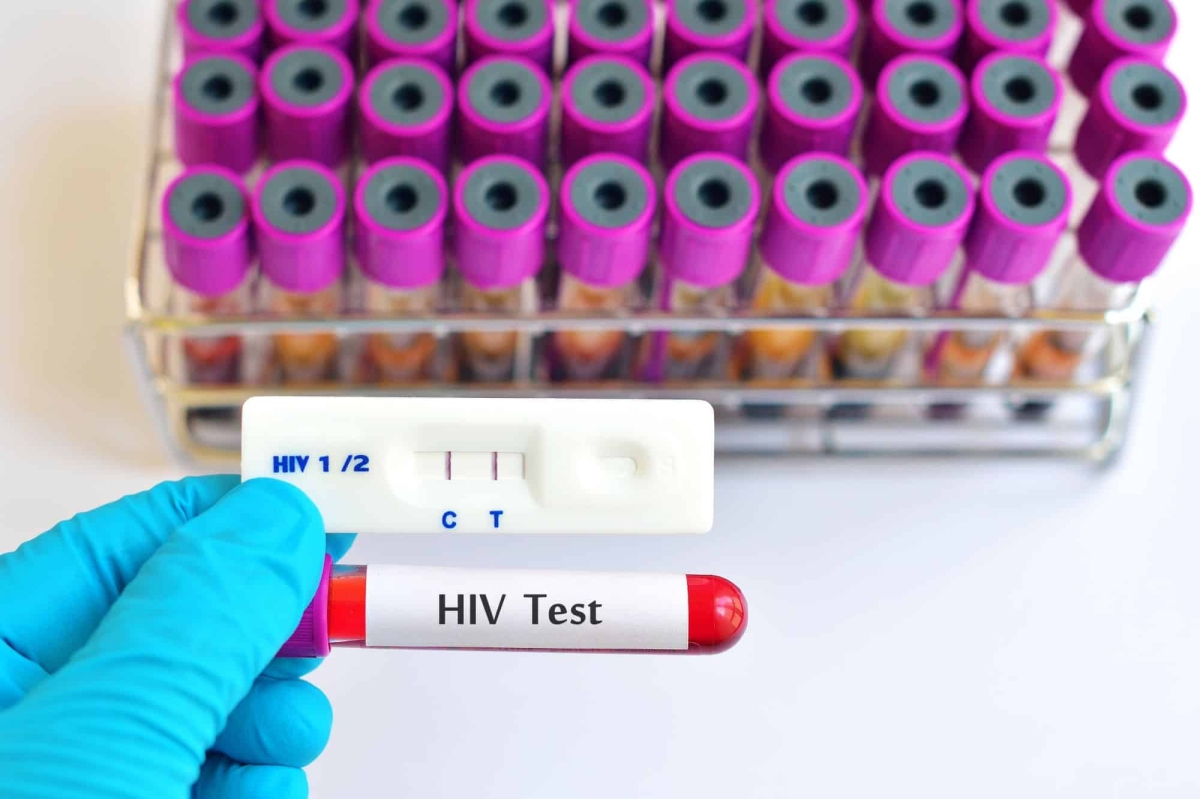 HIV - Foto: Imagem Ilustrativa | Jarun Ontakrai | Shutterstock
