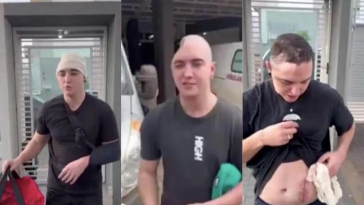 Jovem viraliza após ficar com parte do crânio na barriga - Foto: Reprodução/Print de vídeo Instagram João Cris
