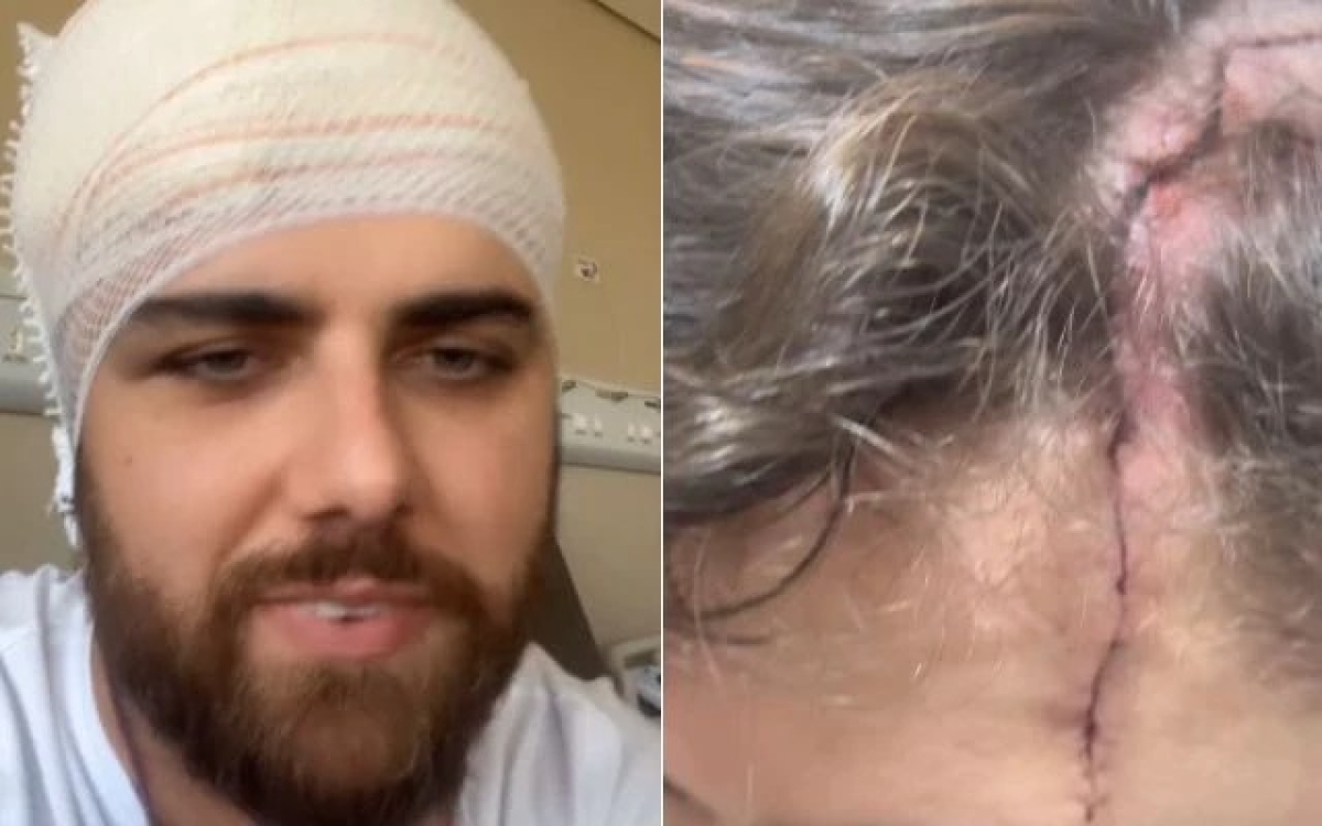 Zé Neto mostra corte na cabeça - Foto: Instagram @zenetotoscanooficial
