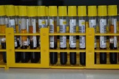 Funcionamento do servio de doao de sangue aos sbados tem alterao em julho (Foto: SES/SE)
